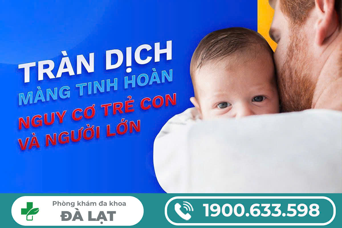 Hình ảnh minh họa